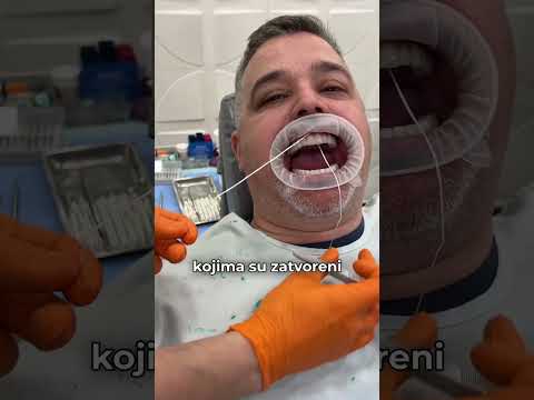 Video 1