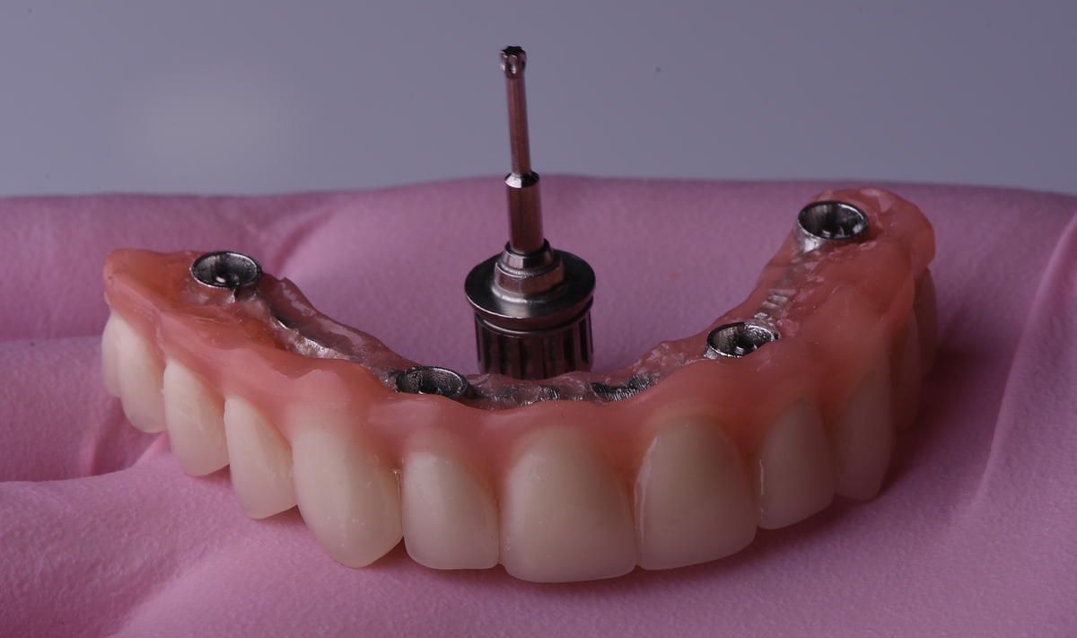 all on 6 plastika