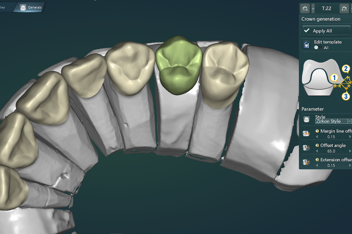 Šta je Digital Smile Design?