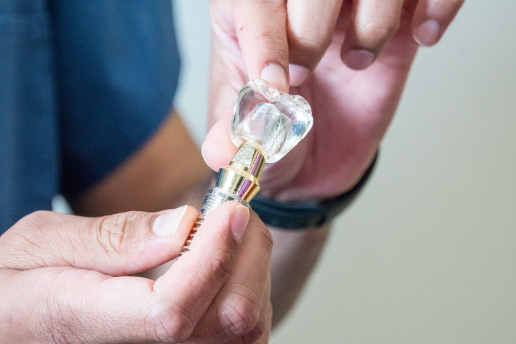 implant izgled