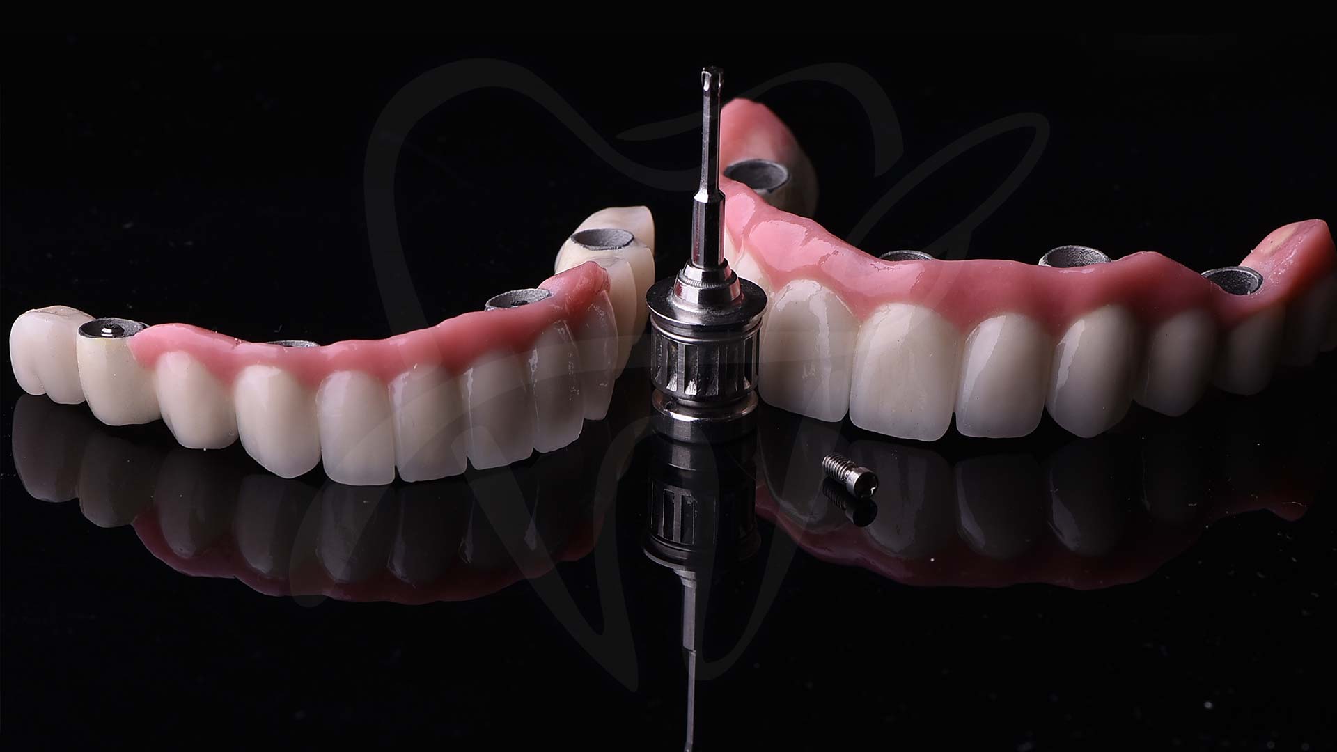implant izgled