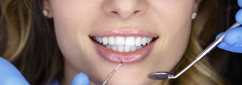 holliwood smile