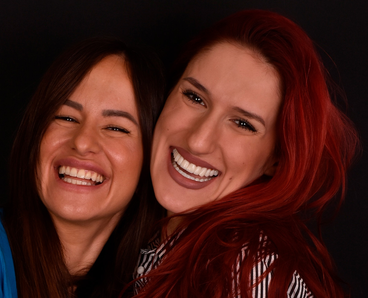 Hollywood smile pacijent — ordinacija Cvejanović