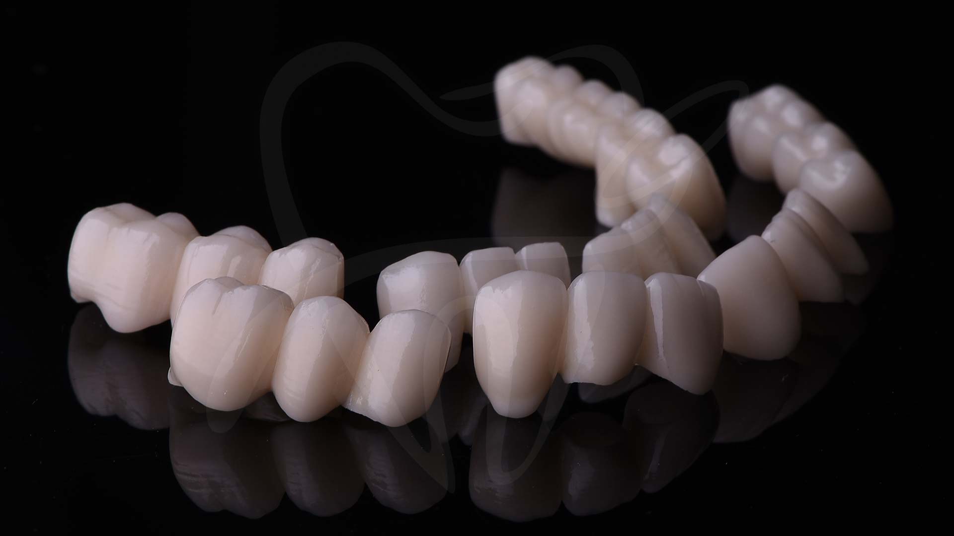 implant izgled