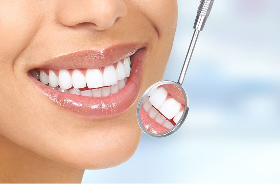 Hollywood smile – vodič za pacijente — ordinacija Cvejanović