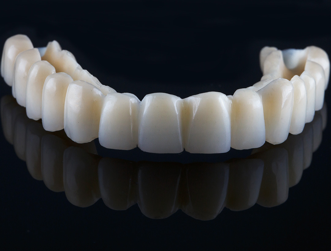 Komplikacije hollywood smile rada — ordinacija Cvejanović