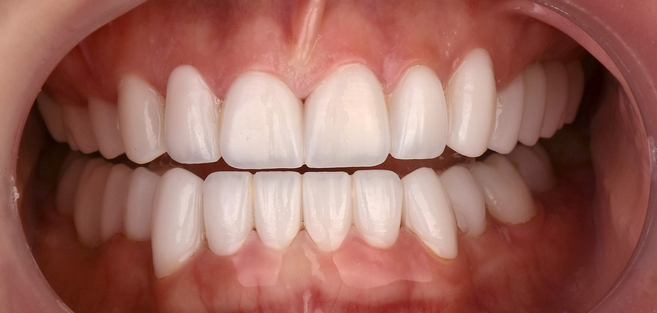 Hollywood smile — ordinacija Cvejanović