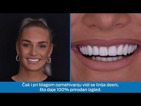 Originalna naslovna fotografija videa: Hollywood smile u punom sjaju